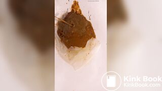 Chinese girl have watery diarrhea1