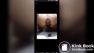 女孩拉出大块儿的粪便