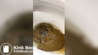 girl diarrhea - video 67