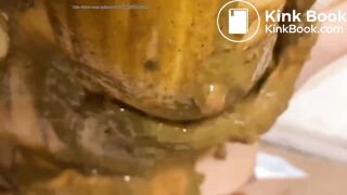Girl diarrhea and smearing