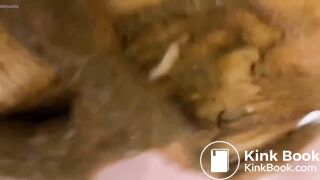 Girl diarrhea and smearing