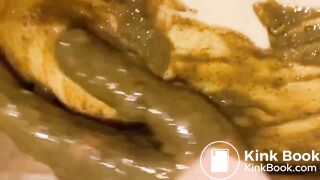 Girl diarrhea and smearing