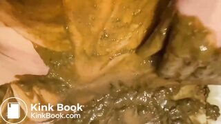 Girl diarrhea and smearing