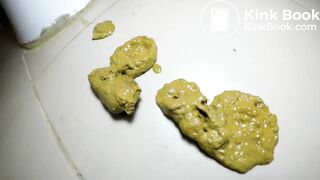 Explosive Diarrhea - video 31