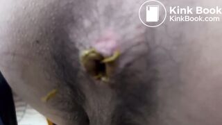 Peeping an Asian Guy Dirty Hole Close Up