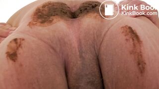 Pooping 677 - Swinging Turds