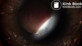 Pooping 537 - Poops Eye View