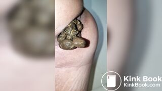 Pooping 514 - Quick Dump