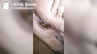 Pooping 433 - Quick Dump Away from Home