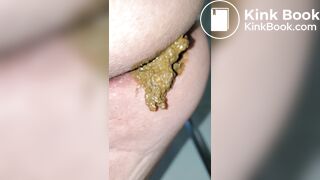 Pooping 379 - Pinch, Run and Shower