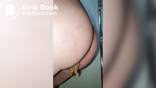 Pooping 310 - Wet Dump