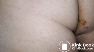 Pooping 303 - On Your Face