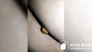 Pooping 270 - Fat Dry Dump, Upclose