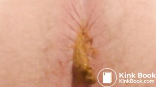Which Anus Produced the Biggest Pile of Poo?