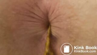 9 Dumps (Part III)