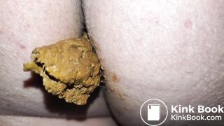 Pooping 203 - Walking the Poop