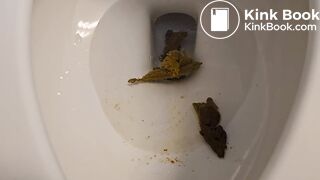 Piles of my Poop 3