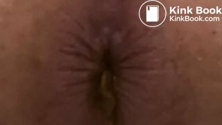 4 Stinky Diarrhea Dumps