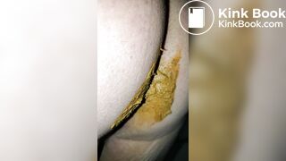 Pooping 79 - Close Up