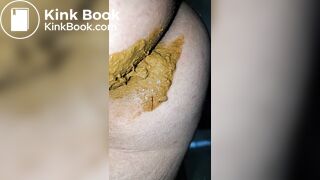 Pooping 79 - Close Up