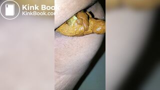Pooping 79 - Close Up