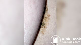 Pooping 43 - Close Up
