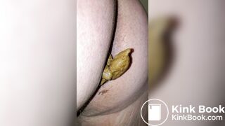 Pooping 24 - Hair Up My Butt