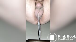 Anal 63 - Deep X Ray