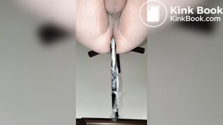 Anal 63 - Deep X Ray