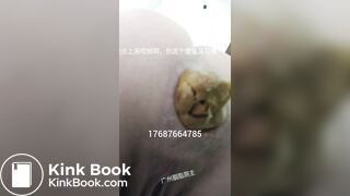 Chinese Girl Pooping